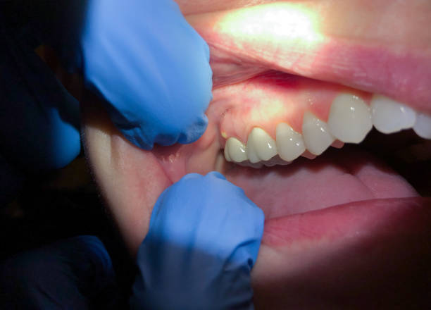 Best Emergency Cosmetic Dentistry (e.g., broken veneers) in Valley Center, CA
